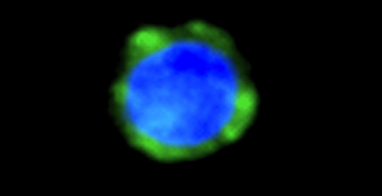 Planarian Neoblast