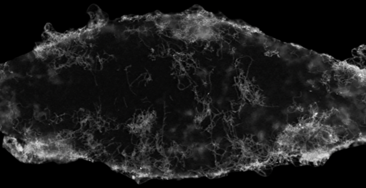 Fungal Infection in planaria