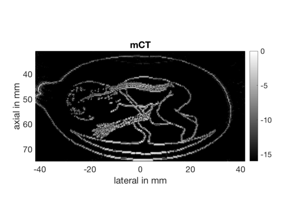 Example of foetus image